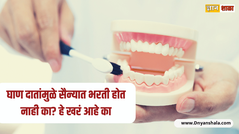 Is artificial teeth allowed in Indian army recruitment?